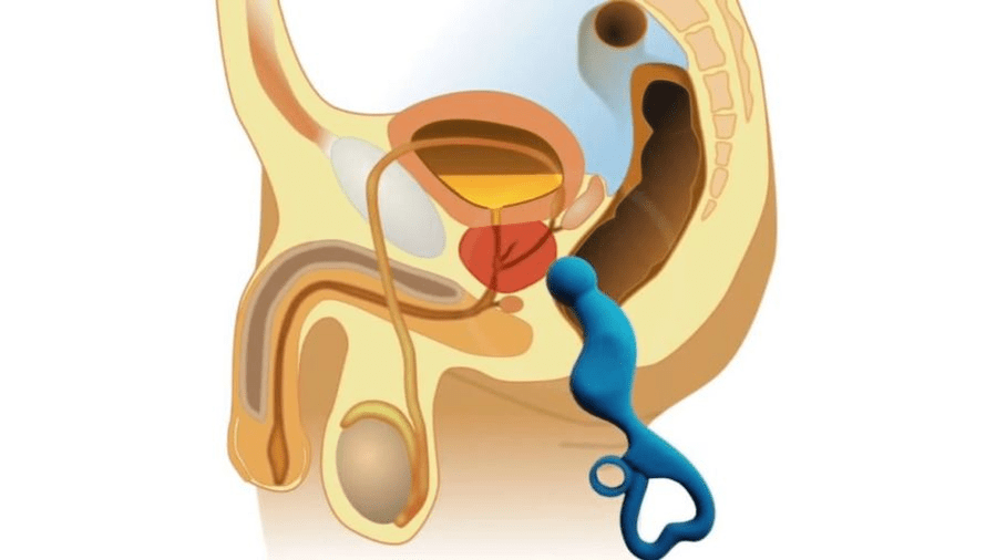 prostate massage for the treatment of prostatitis