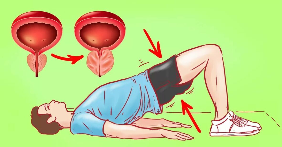 Exercises for prostatitis